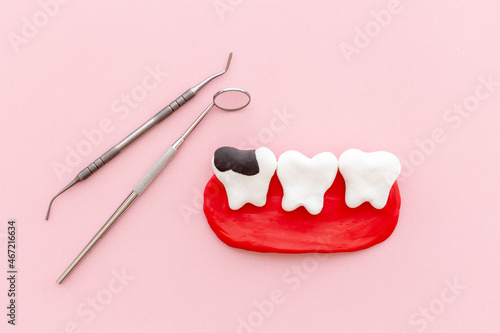 Teeth health and dental care. Caries and plaque concept