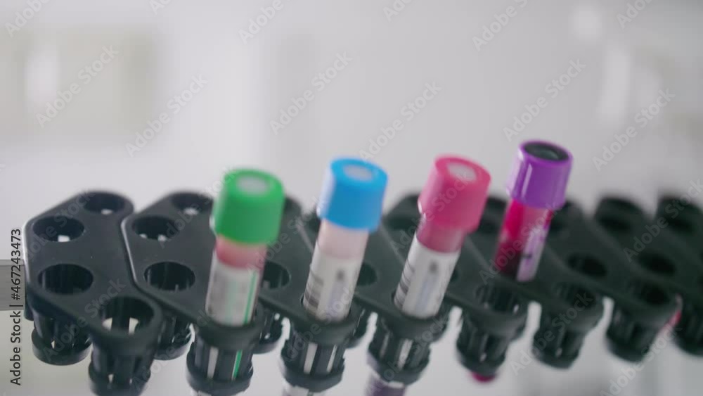 Test Tubes With Material for Laboratory Testing or Experiments. Medical Equipment for Research. Pharmaceutical Laboratory. Concept: Research, Biochemistry, Pharmaceutical Medicine Test Tubes With Material for Laboratory Testing or Experiments. Medical Equipment for Research. Pharmaceutical Laboratory. Concept: Research, Biochemistry, Pharmaceutical Medicine