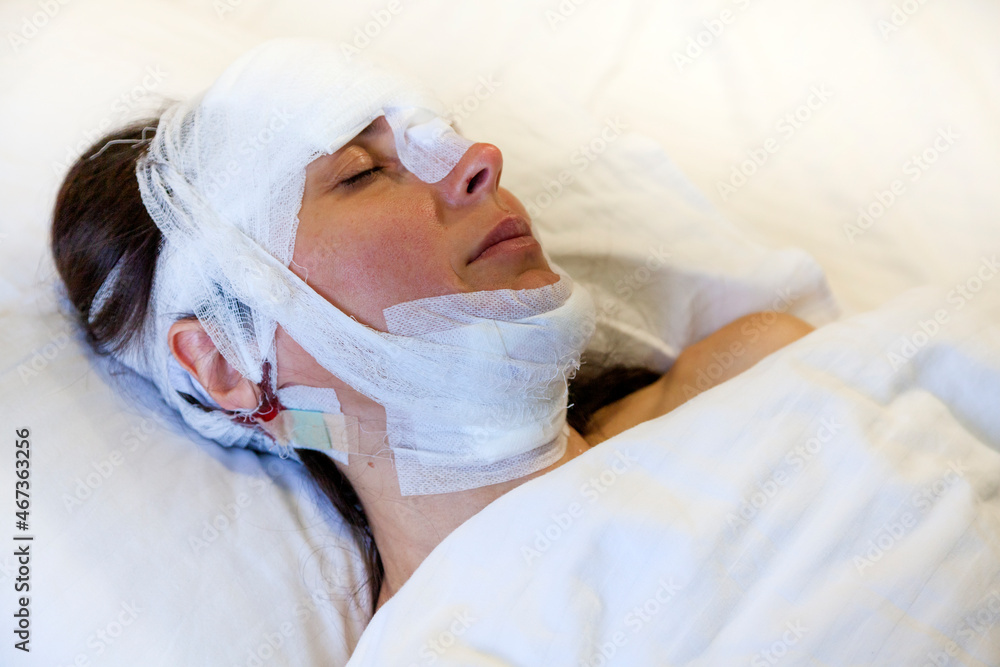 A girl after surgery with a bandaged head lies on the bed. Head trauma, concussion, injured in a car catastrophe A girl after surgery with a bandaged head lies on the bed. Head trauma, concussion, injured in a car catastrophe