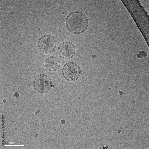 Nanoparticles made of lipids (liposomes) containing an anticancer drug (doxorubicin)