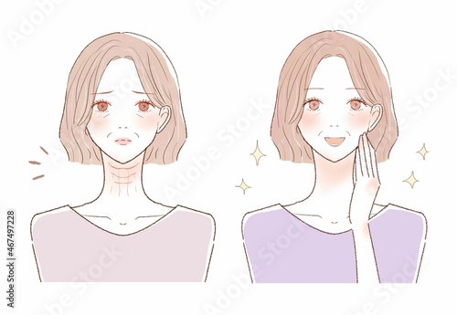 首のしわに悩む中年女性のビフォーアフター