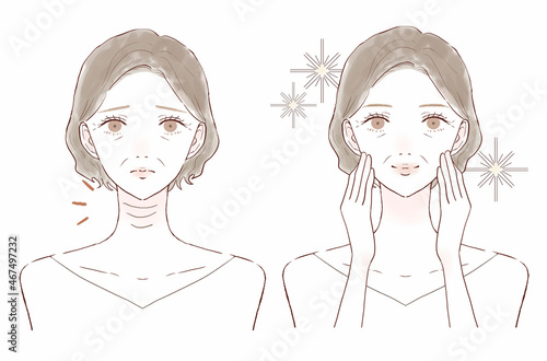 首のしわに悩む中年女性のビフォーアフター