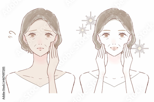 日焼けに悩む中年女性のビフォーアフター