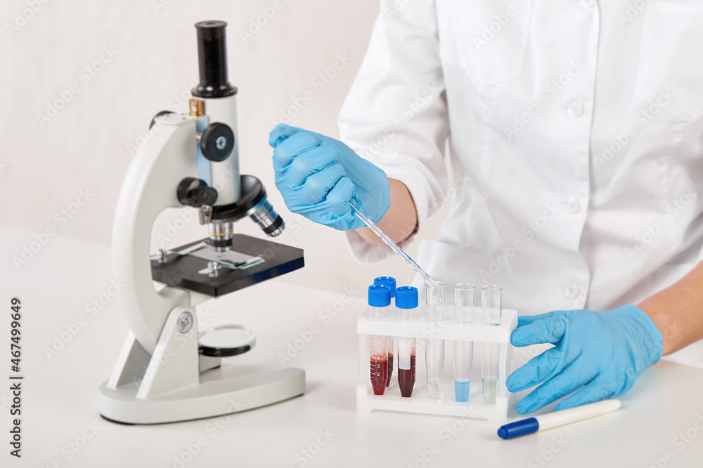 the hands of a laboratory assistant in blue gloves doing the analysis the hands of a laboratory assistant in blue gloves doing the analysis