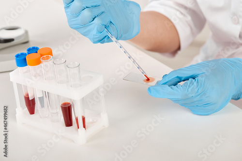 the process of blood analysis using a microscope