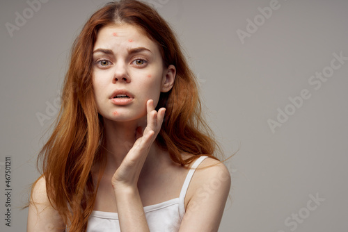 pretty woman facial skin problems dermatology isolated background