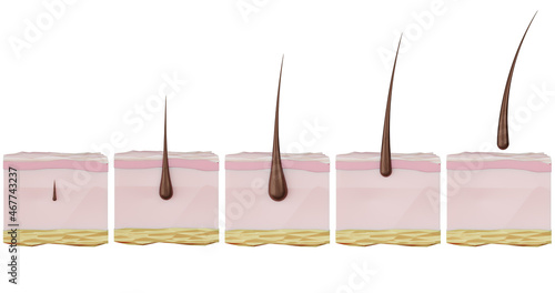 3d illustration of the stages of the recovery cycle hair growth hair loss, baldness, alopecia, hair removal. Hair growth, care, strengthening, removal, hair loss photo