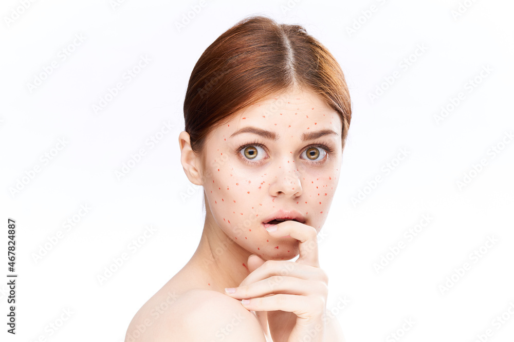 sad woman with bare shoulders red dots on her face sad woman with bare shoulders red dots on her face