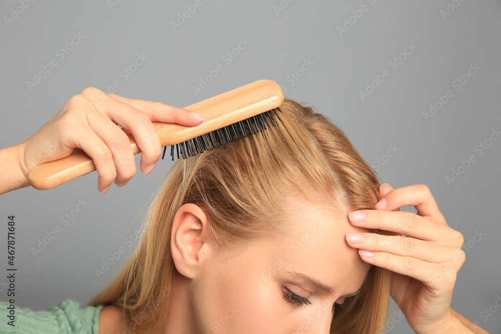Naklejka premium Woman with hair loss problem on grey background, closeup. Trichology treatment
