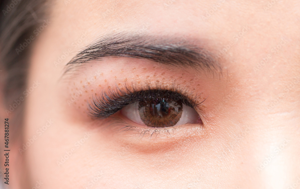 Obraz premium Cosmetic procedure for lifting the skin of the eyelids of Asian eyes. Non-surgical blepharoplasty with plasma IQ apparatus. Facial rejuvenation cosmetology. Beautician makes a cosmetic procedure.