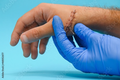 Examination and care of postoperative sutures on the patient's shoulder