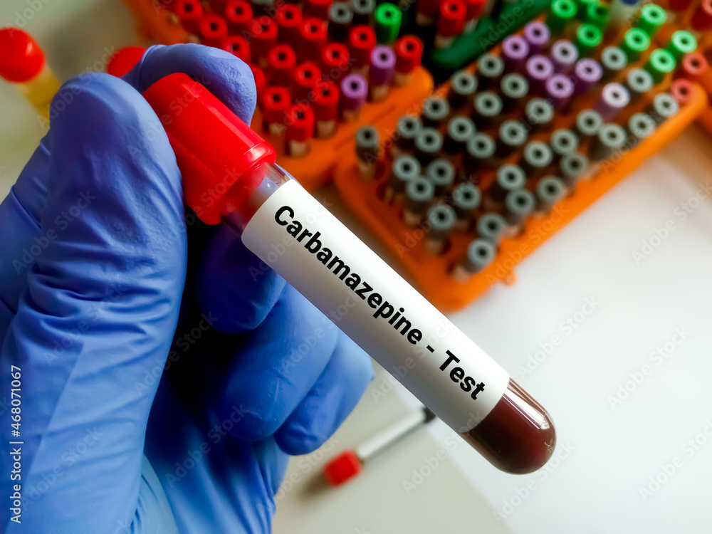 Obraz premium Blood sample for Carbamazepine test, to establish an appropriate dose and maintain a therapeutic level.