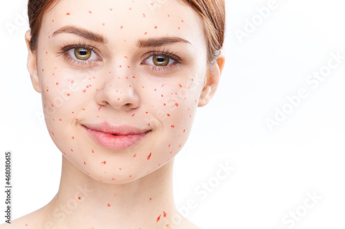 cheerful woman with bare shoulders dermatology pimples