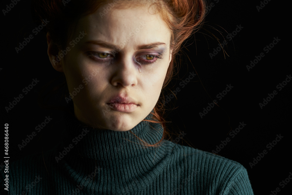 crying woman with black eye problems abuse crying woman with black eye problems abuse