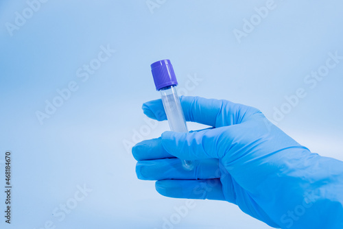 Vacuum tube for collection and blood samples with sodium citrate in blue gloves for laboratory on blue background