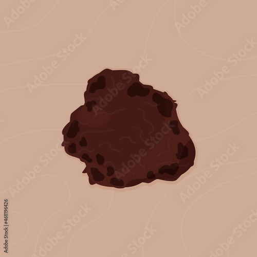Melanoma is a dangerous birthmark. Diagnostics, observation and inspection. Image for skin cancer prevention campaign. Malignant or benign tumor. Vector illustration, flat