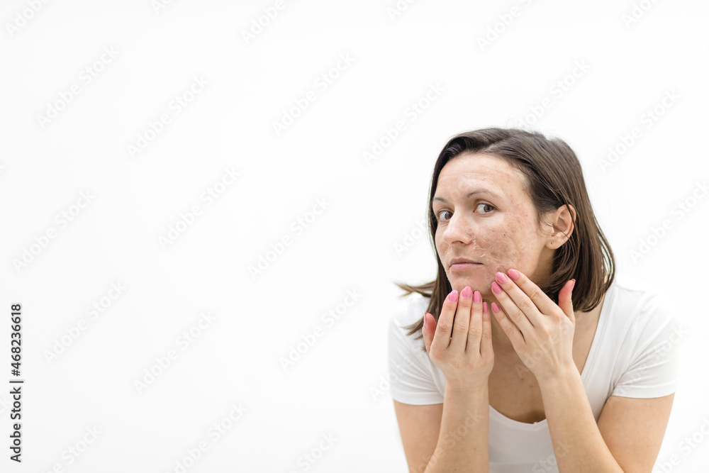 Photo of woman with dry skin touching her face on white background. Photo of woman with dry skin touching her face on white background.