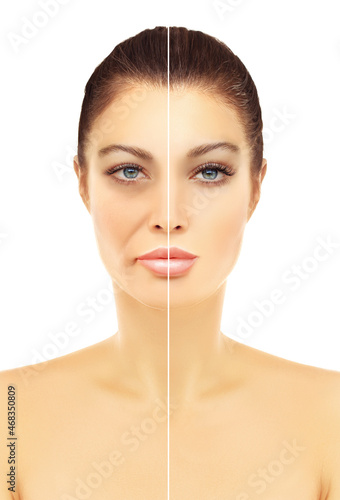 Aging. Mature woman-young woman.Face with skin problem.