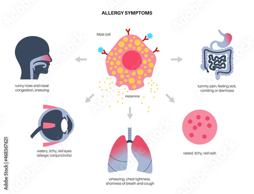 Allergy symptoms concept