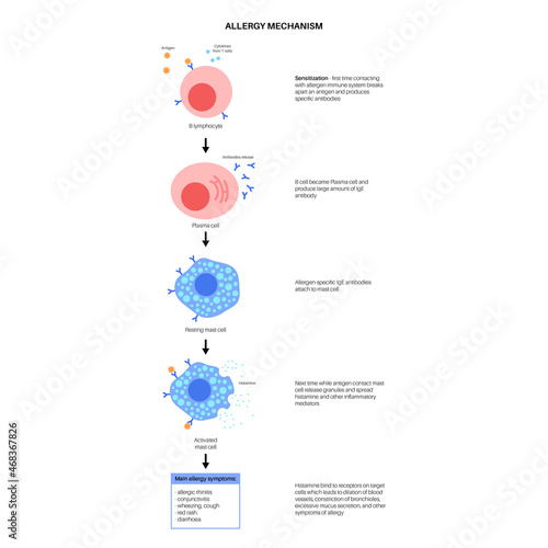 Allergy mechanism diagram