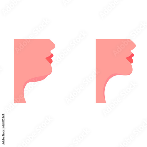 Female profile with and without a double chin. Before and after. Concept: face contour correction, face contouring, rejuvenation. Vector illustration, flat minimal cartoon design isolated.