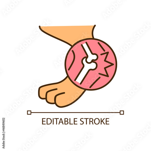 Arthritis RGB color icon. Joints inflammation. Hips and elbows affecting illness. Pet animal disease. Lameness and stiffness. Isolated vector illustration. Simple filled line drawing. Editable stroke