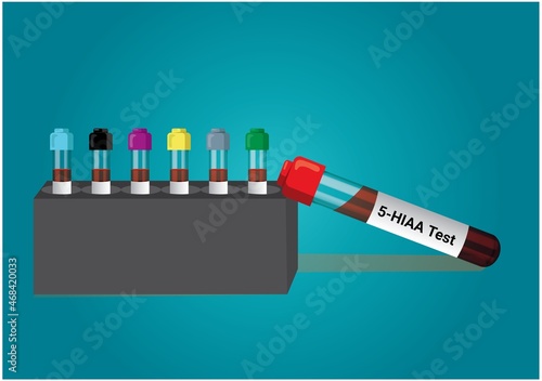 Blood sample for 5-Hydroxyindoleacetic acid (5-HIAA) test, Serotonin. Medical test tube in laboratory background. photo