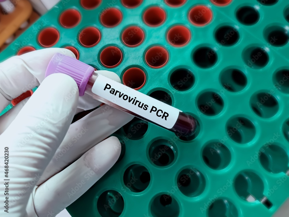 Obraz premium Biochemist or doctor holds blood sample for Parvovirus PCR test. Medical test tube in laboratory background.