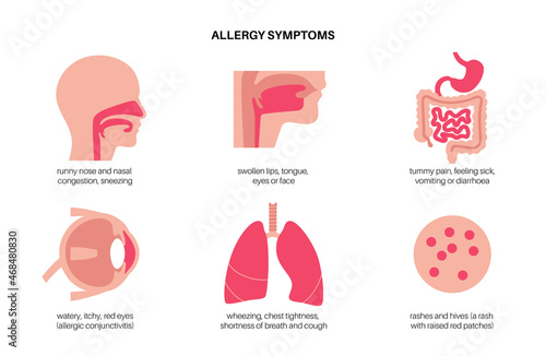 Allergy symptoms concept