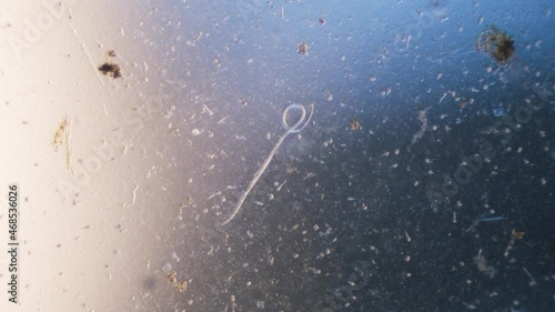 Nematode parasitic worm in microscope bright field