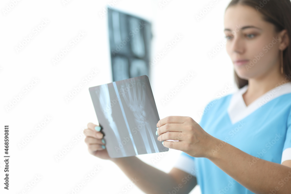 Traumatologist doctor looking at xray of hand in clinic closeup Traumatologist doctor looking at xray of hand in clinic closeup