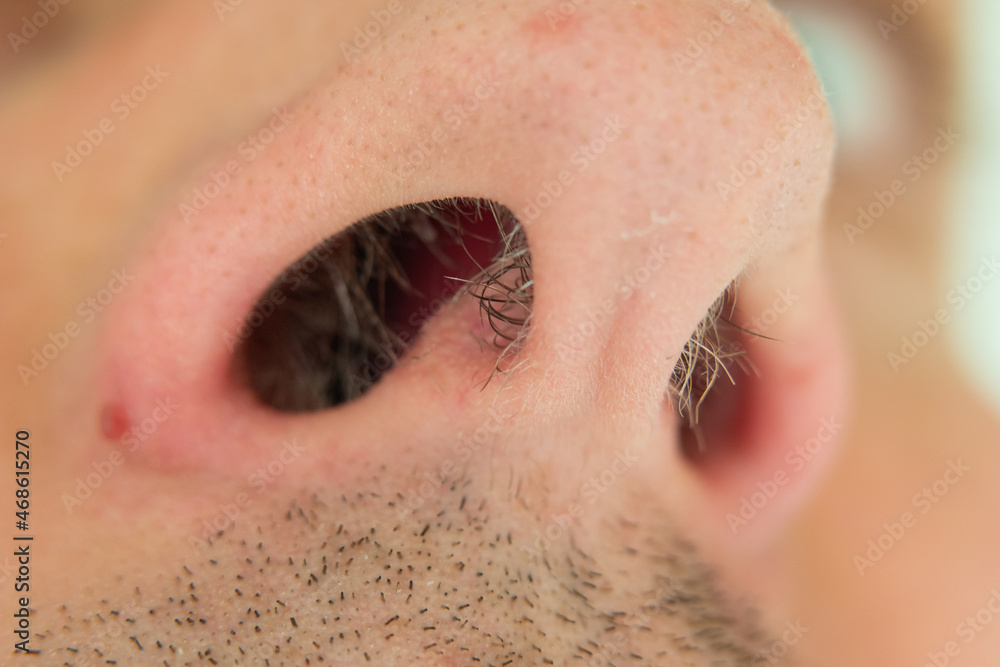Caucasian male unkempt nose hair follicles macro close up shot. Close up shot, unrecognizable Caucasian male unkempt nose hair follicles macro close up shot. Close up shot, unrecognizable