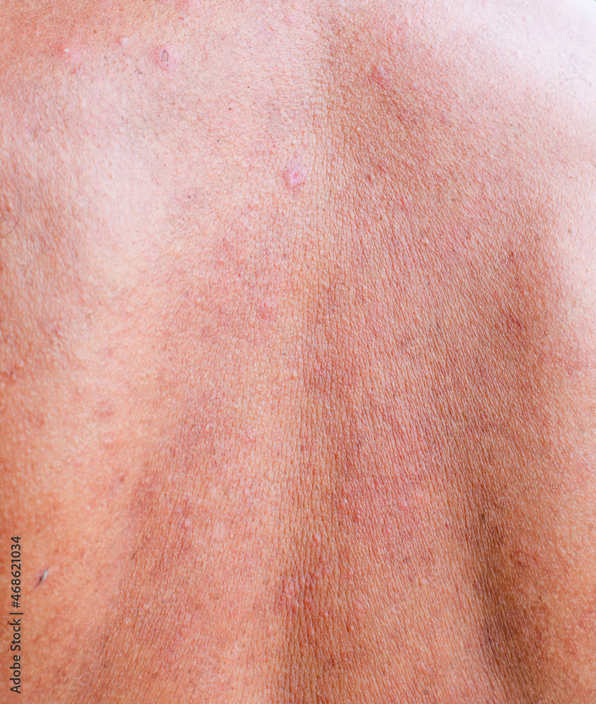 An image of the rough skin of an older person.