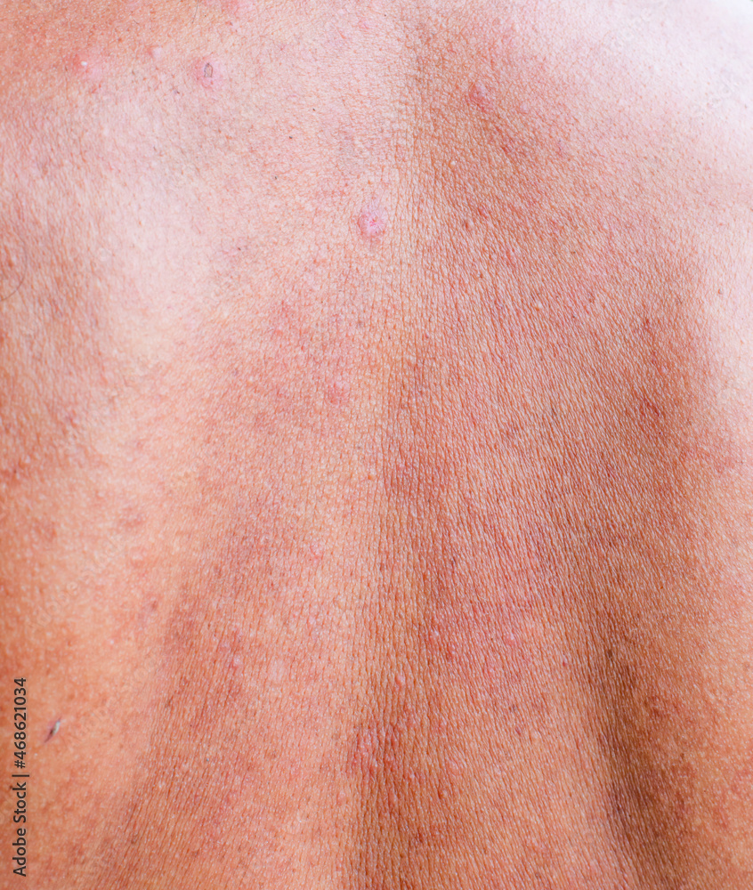 An image of the rough skin of an older person. An image of the rough skin of an older person.