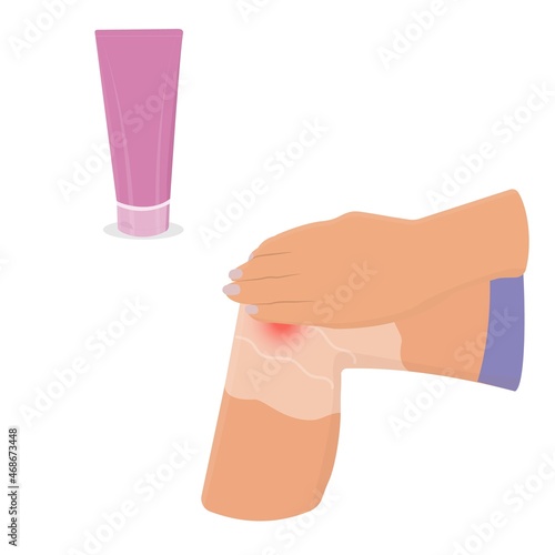 Ointment for knee pain. Vector flat illustration