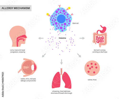 Allergy symptoms concept