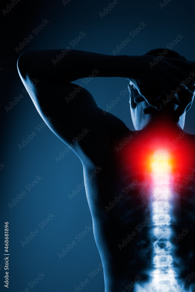 Naklejka premium Human spine in x-ray on blue background. The neck spine is highlighted by yellow red colour.