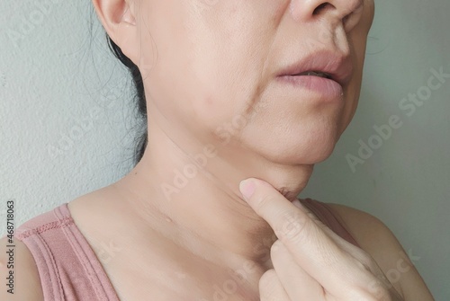 close up beside of a woman squeezing sagging skin under the neck.