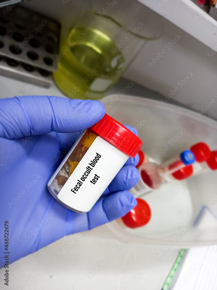 Stool sample for Fecal occult blood test (FOBT), colorectal cancer