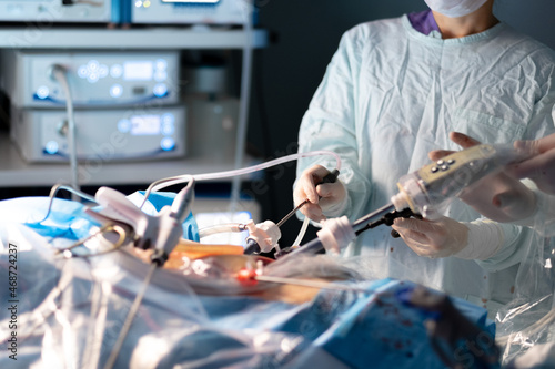 Selective focus on the hand of a surgeon with a surgical instrument during a surgical operation. The surgeon operates with a trocar laparoscopic forceps. Laparoscopic minimally invasive surgery.
