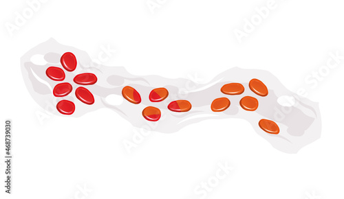 Red blood cells transformed due to high uric acid level 
Cause disease like: hyperuricemia, gout