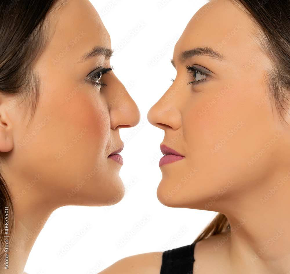 comparative portrait of female face, before and after plastic surgery of the nose comparative portrait of female face, before and after plastic surgery of the nose