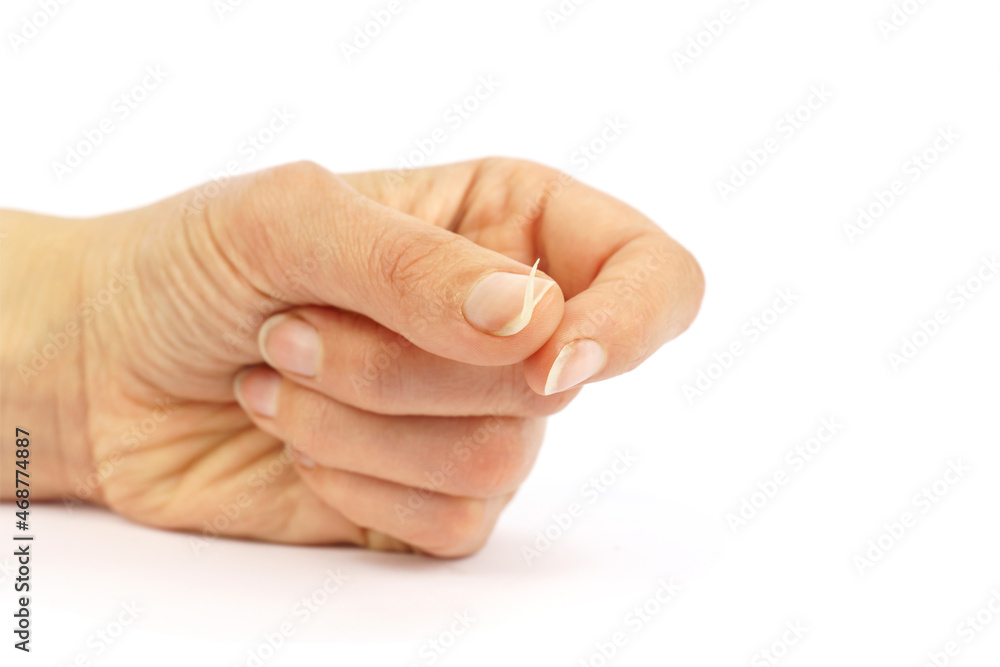 female hand with broken nail isolated on white female hand with broken nail isolated on white
