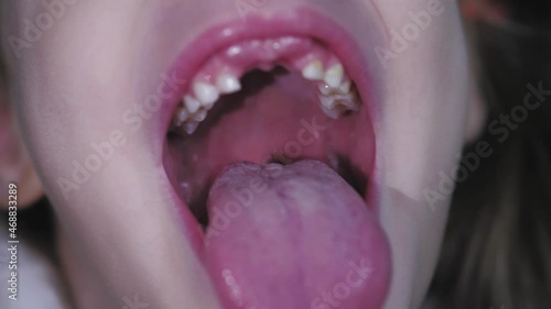 girl opens her mouth wide and pulls out long tongue. child shows his teeth soft palate and mouth to dentist. mouth is wide open, tongue is stuck out as far as possible, with clear view of tongue