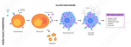 Allergy mechanism diagram photo
