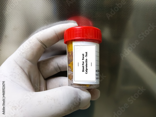 Doctor holding stool specimen jar for Faecal Calprotectin test. To diagnosis Inflammatory Bowel Disease photo