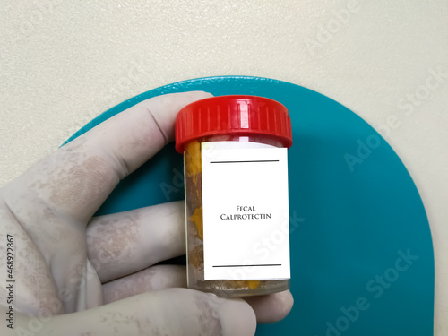 Doctor holding stool specimen jar for Faecal Calprotectin test. To diagnosis Inflammatory Bowel Disease photo