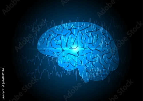 Focal seizure. Abnormal brain waves or EEG arising from one region of brain on blue technology background. 