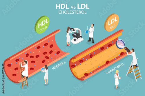 3D Isometric Flat Vector Conceptual Illustration of HDL Vs. LDL Cholesterol, Narrowing of Coronary Arteries that Causes of Atherosclerosis photo
