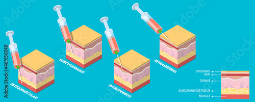 3D Isometric Flat Vector Conceptual Illustration of Injection Types, Different Techniques of Safe Injections photo
